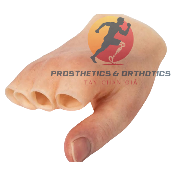 Tay thẩm mỹ mất ngón